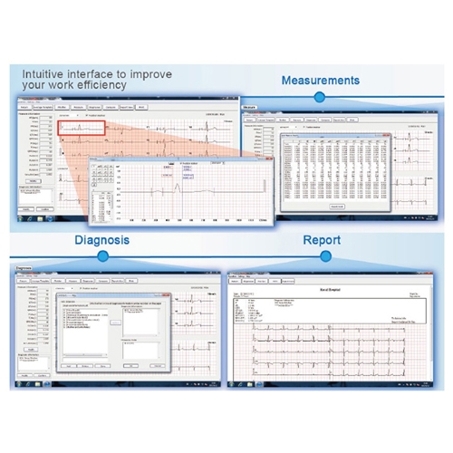ECG-viewer software (English and Italian) - for Smart ECG