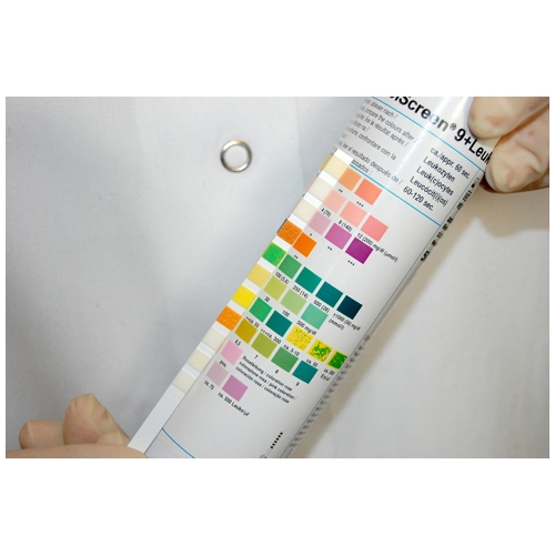 Urine analysis strips - 11 parameters (Visual) - tube of 100 strips