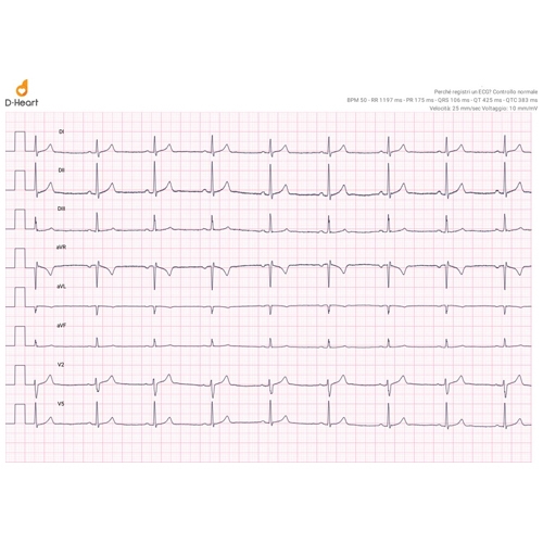 D-Heart 8-12 channels ECG